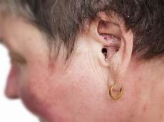 Ear Cradle