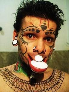 Eye Stretcher