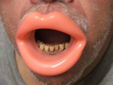 Rubber Stretcher