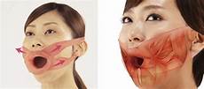 Skin Stretcher