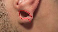 Stretcher Hole