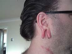 Thumb Stretcher